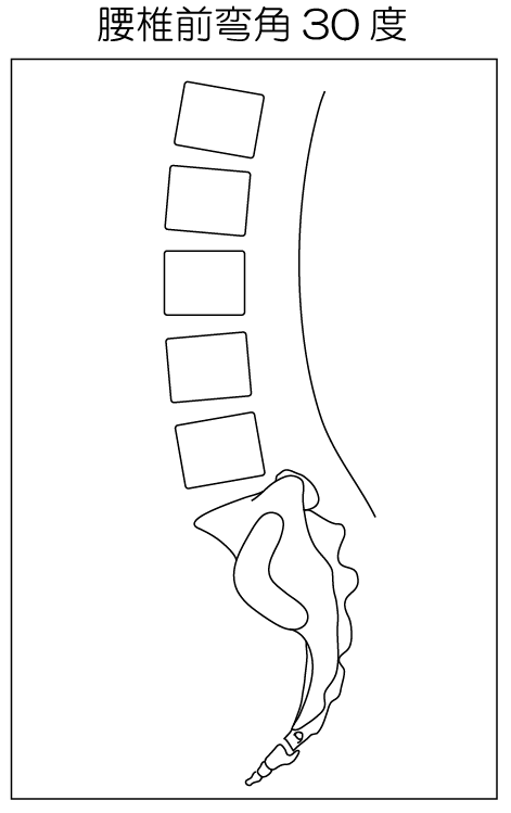 ～腰はもともと反っている～