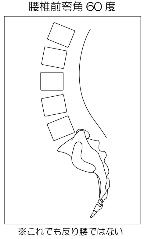 ～腰はもともと反っている～