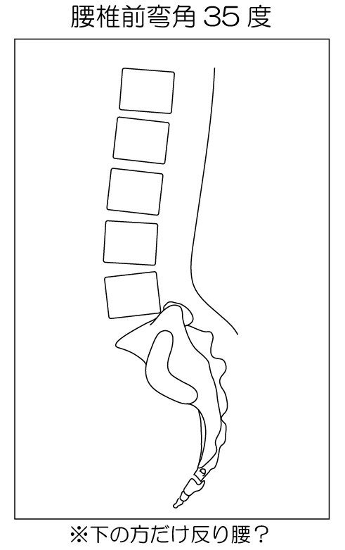 ～腰はもともと反っている～