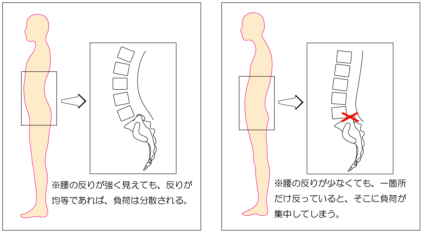 ～反り腰は良くないのか？～